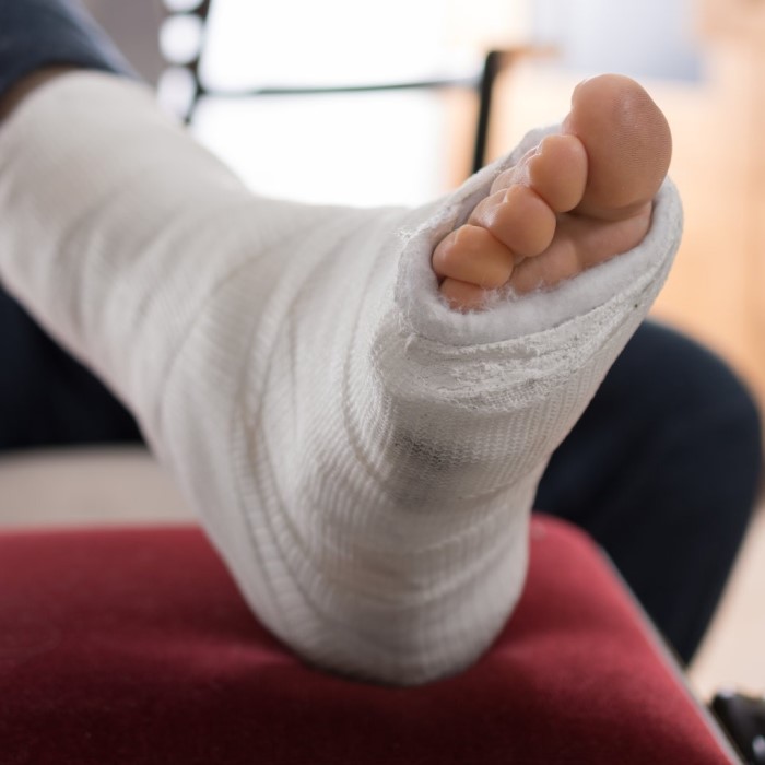 plaster-casts