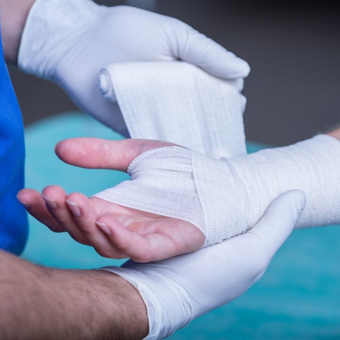 plaster-casts