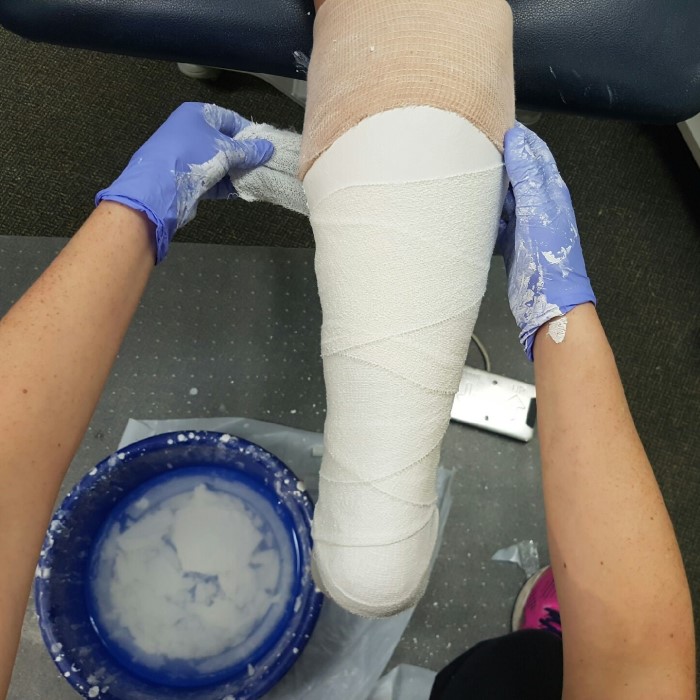 plaster-casts