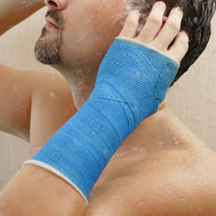 plaster-casts