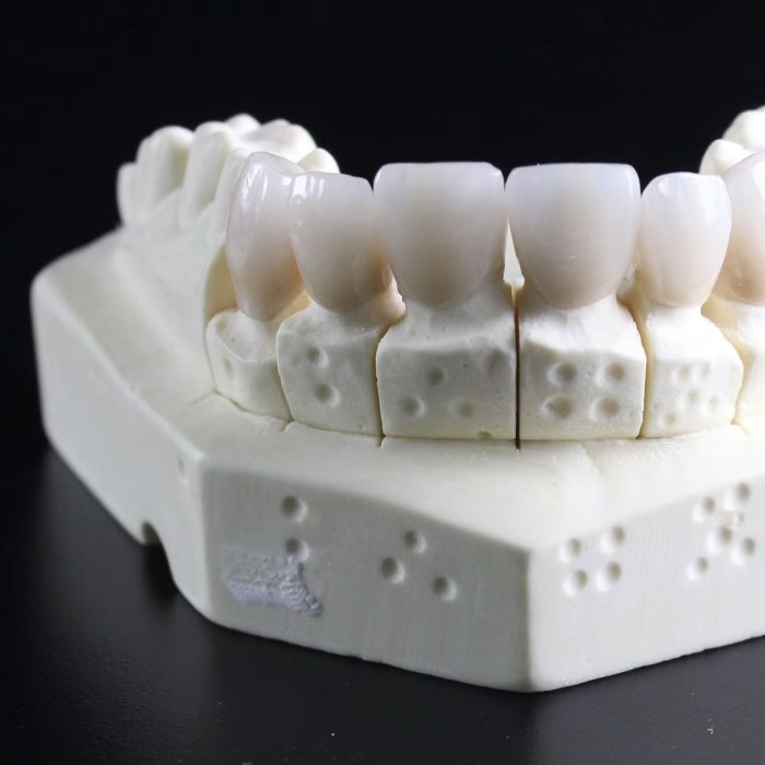 medical ceramics market