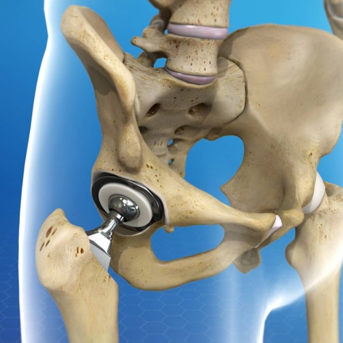 medical ceramics market
