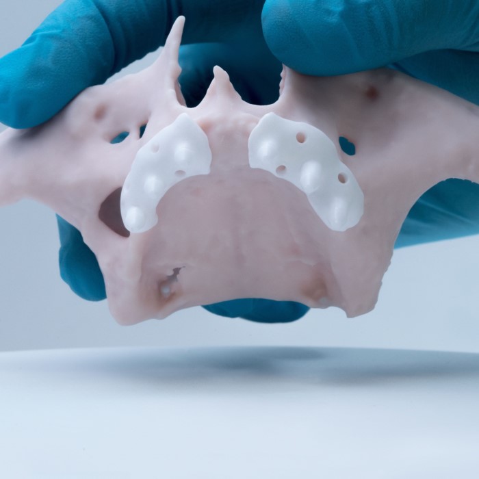 medical ceramics market