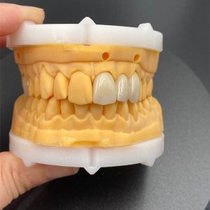 medical ceramics market