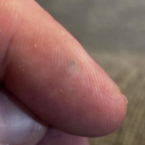 what does ink poisoning look like