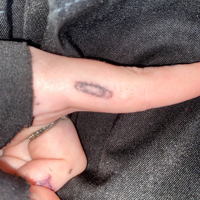what does ink poisoning look like